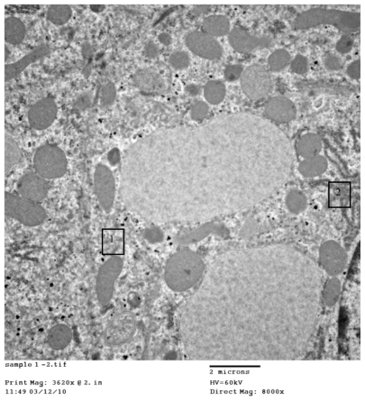 Figure 3C 1) Even distribution of cerium oxide over the cytoplasm of the hepatocytes. 2) Normal ribosomes (rough endoplasmic reticulum), original magnification ×8000.