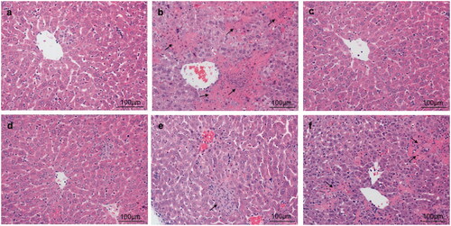 Figure 6. Effects of taraxasterol on hepatic histological alteration in Con A-induced acute hepatic injury (200×). The mice were treated with taraxasterol (10, 5 and 2.5 mg/kg, respectively) or Bif and injected a single dose of Con A. Hepatic histological alteration was observed under the optical microscope by H&E staining. (a) Normal group; (b) Con A group; (c) Bif + Con A group; (d) Taraxasterol 10 mg/kg + Con A group; (e) Taraxasterol 5 mg/kg + Con A group; (f) Taraxasterol 2.5 mg/kg + Con A group.
