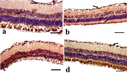 Figure 4. A photomicrograph of the cross section of the rat retina in the experimental groups (anti-F-actin immunostain). A: CONT group showing marked positive expression (green arrow), especially in the photoreceptor layer (PRL), inner nuclear layer (INL), and ganglion cell layer (GCL). B: STZ group showing mild positive expression (green arrow), especially in PRL, INL, and GCL. C: STZ+MTF group showing mild to moderate positive expression (green arrow), especially in PRL, INL, and GCL. D: STZ+ MTF-NE group showing moderate to marked F-actin positive expression (green arrow), especially in PRL, INL, and GCL. (Scale bar = 50µm).