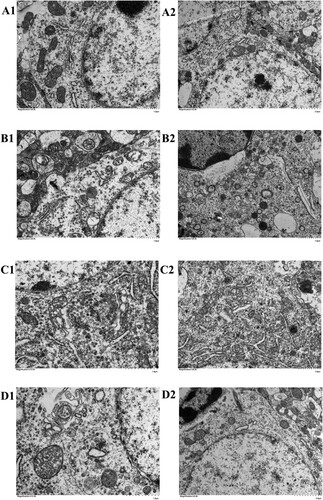 Figure 3. Typical electron micrographs. (A) control group, (B) model group, (C)TSG group, (D) Mito-TSG group. A2, D2 × 5.0k. A1, B1, B2, C2 × 8.0k. C1, D1 × 12.0k.