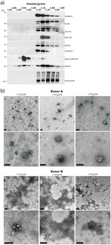 Figure 3. Analysis of EV enrichments from synovial fluid by sucrose density gradient ultracentrifugation.(a) Sucrose density gradient ultracentrifugation fractions were assessed for the presence of EV markers and specific contaminating proteins by Western blot with equal fraction volumes loaded. Results are from the same SF sample that was used for Figure 2b, and are representative of results observed with other donors. (b) Negative staining TEM analysis of EV containing fractions from two separate donors showing the presence of EVs (black arrows) and unspecified material (white arrows). Scale bars = 200 nm.