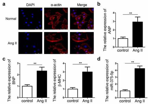 Figure 1. miR-337-5p expression is upregulated in cardiomyocytes subjected to Ang II treatment. (a) The morphology and size of cardiomyocytes subjected to Ang II treatment were evaluated by immunofluorescence staining of α-actin (n = 6). (b, c) The levels of myocardial hypertrophy biomarkers ANP, BNP, and β-MHC were detected using qPCR (n = 3). (d) The expression of miR-337-5p was detected with qPCR (n = 3). **p < 0.01