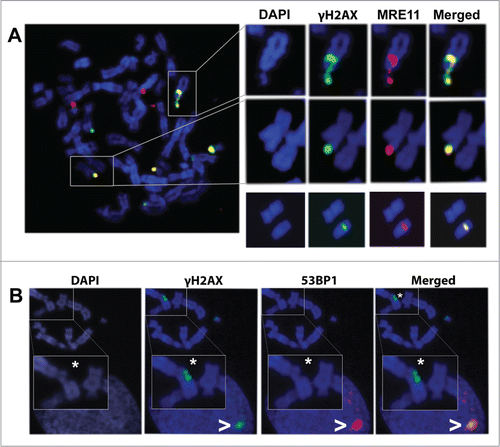 Figure 5. Co-localization pattern of γH2AX foci with MRE11 and 53BP1. (A) A metaphase spread showing γH2AX and MRE11 co-localization. These 2 proteins co-localize at sites of chromatin damage such as a chromosome break (upper row) and at sites of apparently intact chromatin (middle row). In the lower row, an apparently intact chromosome from a different metaphase bears an internal γH2AX focus that also co-localizes with MRE11. (B) Analysis of 53BP1 and γH2AX shows that, after irradiation, 53BP1 co-localizes with γH2AX foci at interphase nuclei (>) but not with γH2AX foci located on mitotic chromosomes, even when these foci are signaling chromatin breaks (*).