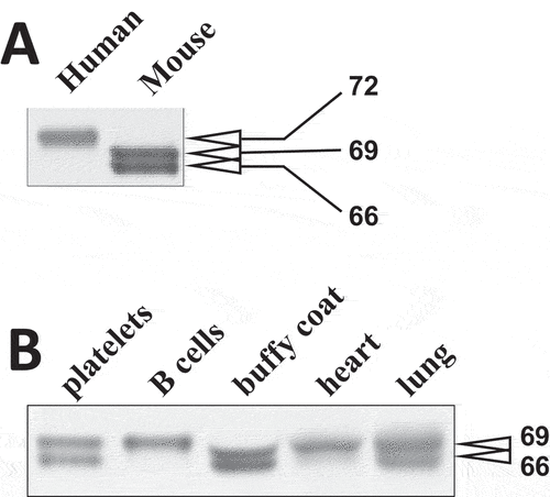 Figure 2. Molecular masses of Syk isoforms in various tissues. (A) lysates of human and mouse platelets were resolved using SDS-PAGE and probed with SYK-01, a monoclonal antibody raised against the 5-360aa region of Syk. (B) lysates of various mouse cells and tissues as indicated have been analyzed as described in (A). The molecular masses of Syk isoforms determined using protein standards are indicated in (A) and (B). The data are representative of at least three independent experiments from three different human donors and mice.
