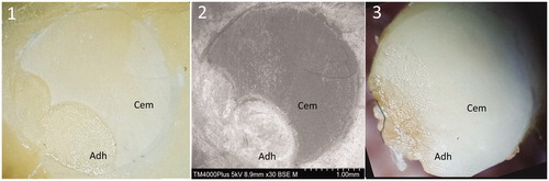 Figure 6. Examples of a mostly cohesive fracture morphology: Combination B-c. (1) Tooth surface X (light microscope), (2) tooth surface X (SEM), (3) dentin cylinder, surface Z (light microscope). Surface Adh: adhesive, Cem: resin cement.