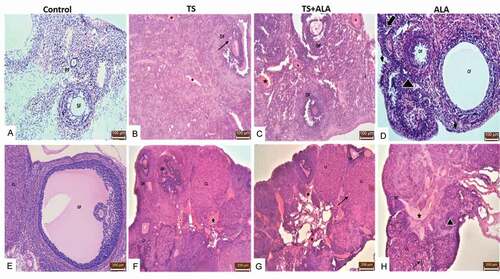 Figure 4. Photomicrographs of the effects of maternal tobacco smoke and/or ALA treatment on offspring ovary tissue: (A,E) control groups; normal ovarian tissue and some follicles; primary follicle (PF), secondary follicle (SF), Graafian follicle (GF), corpus luteum (CL) (B,F) (x20, x10 respectively) TS groups; ovarian tissue showing degenerated follicle (DF), vascular congestion (star), atretic follicle (AF), cystic follicle (CF) vacuolization in granulosa cells (black arrow) (C,G) (x20, x10 respectively) TS+ALA groups; ovarian tissue showing vacuolization in corpus luteum (black arrow), vascular congestion (star), degenerated follicle (DF) (D,H) (x20, x10 respectively) ALA groups; ovarian tissue showing germinal epithelial degeneration (arrowhead), decreased primordial follicle (thick arrow), increased inflammatory cell (triangle) (x20, x10 respectively) (Hematoxylin&Eosin).