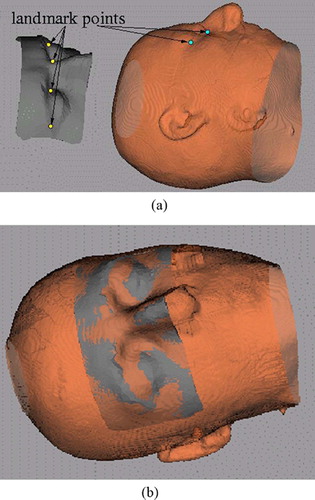 Figure 6. Registration between intraoperative surface scan and preoperative surface model from CT/MRI. (a) Before registration. (b) After registration. [colour version available online.]