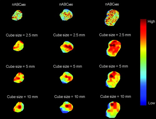 Figure 4.  Axial nABC480 maps and simulated, adapted dose maps for cube sizes of 2.5, 5 and 10 mm for three different bladder tumors.