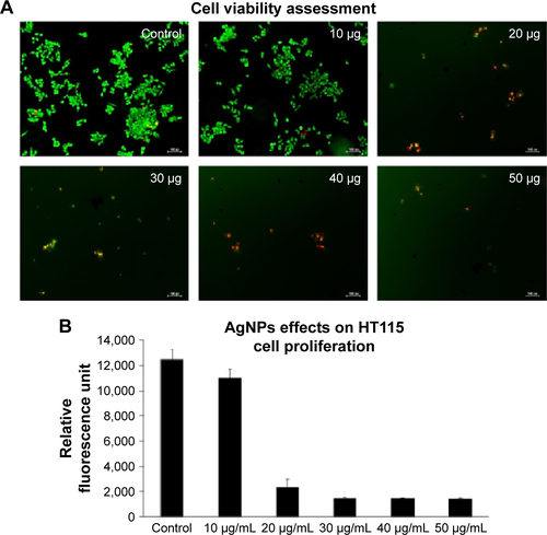 Figure S2 (A) cytotoxic effects of AgNPs (high dose) on HT115. (B) Alamar blue assay showing the proliferation.Note: (A) scale bars= 10 µm.Abbreviation: AgNPs, silver nanoparticles.