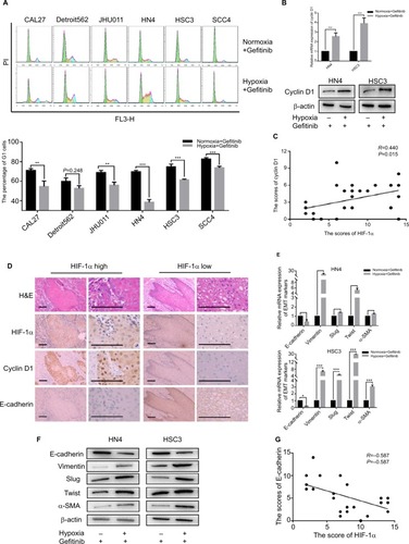 Figure 2 Hypoxia promoted G1–S cell cycle progression and EMT.Notes: After being treated with 1 µM gefitinib in normoxia or hypoxia for 48 hours, (A) cell cycle was detected by flow cytometry. (B) The expression of cyclin D1 in mRNA and protein level was analyzed by qPCR and Western blot (**P<0.01 and ***P<0.001 compared with normoxia). (C) Relativity between the expression of HIF-1α and cyclin D1 in clinical HNSCC specimens (n=30, R=0.440, P=0.015). (D) Representative images of H&E staining and IHC of HIF-1α, cyclin D1, E-cadherin in HNSCC specimens (scale plate represents 200 µm). (E and F) Expression of EMT markers in mRNA and protein level was analyzed by qPCR and Western blot following treatment with their own IC50 value in normoxia or hypoxia for 48 hours (*P<0.05, **P<0.01, and ***P<0.001 compared with normoxia). (G) Relativity between the expression of HIF-1α and E-cadherin in clinical HNSCC specimens (n=30, R=0.587, P=0.001).Abbreviations: EMT, epithelial–mesenchymal transition; HNSCC, head and neck squamous cell carcinoma; HIF-1α, hypoxic inducible factor-1α; IHC, immunohistochemistry; PI, propidium iodide; qPCR, quantitative PCR; α-SMA, α-smooth muscle actin; PI, propidium iodide.