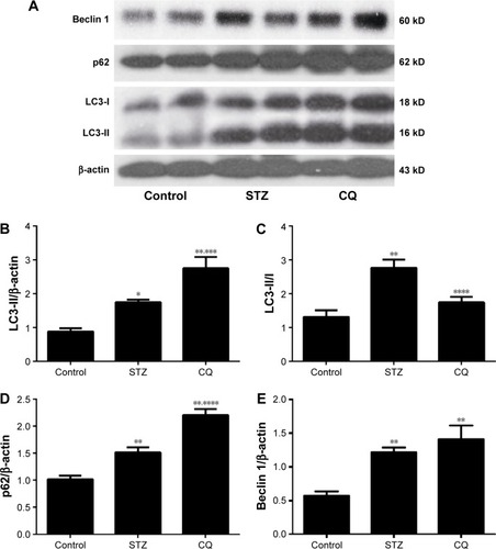 Figure 4 Effects of CQ on the expression of LC3, p62, and beclin 1 in the heart of STZ-induced mice.