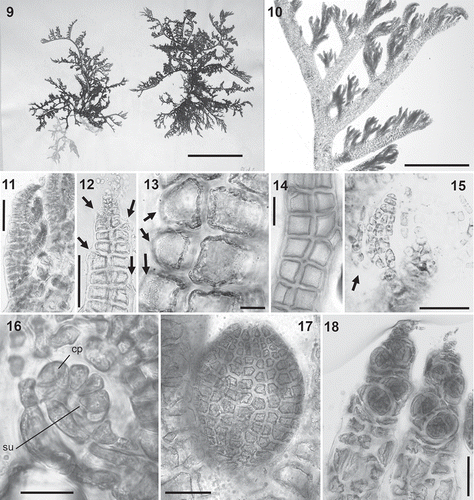 Figs 9–18. Fernandosiphonia unilateralis type material, the type species of Fernandosiphonia. Fig. 9. Herbarium specimen. Figs 10–11. Branches unilaterally arranged. Fig. 12. Axis with scar cells of trichoblasts (arrows). Figs 13–14. Surface view of pericentral cells with plastids lying only on the radial walls, so that the outer walls appear transparent (Fig. 13, arrows) and cells have a dark flank (Fig. 14). Fig. 15. Young spermatangial branch formed on the first dichotomy of a trichoblast, the other branch remaining vegetative (arrow). Fig. 16. Procarp (su = supporting cell; cp = carpogonium). Fig. 17. Cystocarp. Fig. 18. Tetrasporangia arranged in short spiral series. Scale bars: Fig. 9, 3 cm; Fig. 10, 2 mm; Fig. 11, 450 µm; Figs 12, 14, 17 and 18, 100 µm; Figs 13 and 15, 40 µm; Fig. 16, 20 µm.