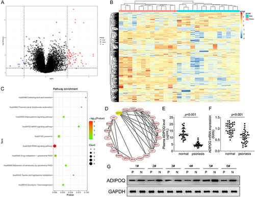 Figure 1 ADIPOQ was up-regulated in the psoriasis patients. The DEGs in the psoriasis patients were expressed as Volcano (A) and heat maps (B). (C) The KEGG enrichment of DEGs in the psoriasis patients. (D) PPI diagram of DEGs in the psoriasis patients. (E) The ADIPOQ contents in the plasma of psoriasis patients were detected by ELISA kit. The mRNA (F) and protein (G) levels of ADIPOQ in the skin samples of psoriasis patients were detected by RT-qPCR and Western blot assays.