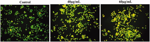 Figure 8. AL-AuNPs activate apoptosis through the activation of a dual staining method by AO/EtBr in HCT-116 colon cancer cells.