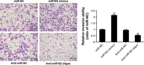 Figure 6 miR182 promotes the invasion of OSCC cells.