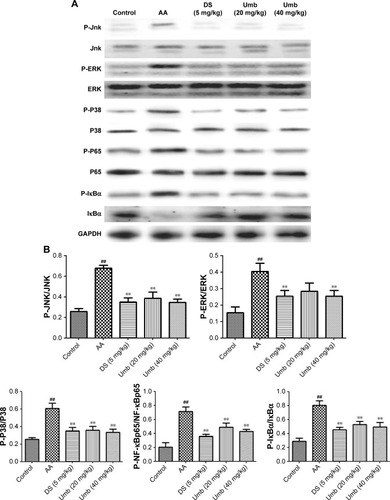 Figure 4 Effects of Umb on the expression of MAPK/NF-κB signaling in synovial tissue.