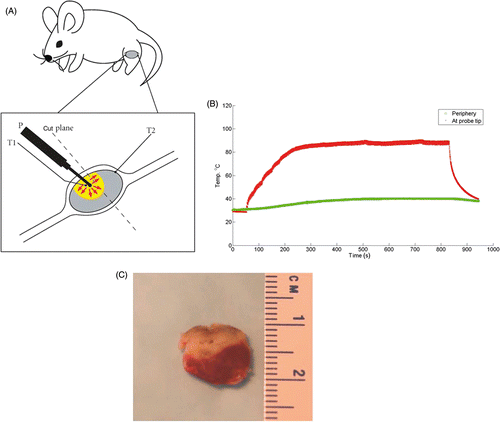Figure 1. Conductive interstitial thermal therapy (CITT) of 4T1 murine tumor: ablation characteristics and tumour damage. (A) CITT treatment and tumour sample preparation. The CITT ablation probe (P) was inserted perpendicularly to the skin surface. Two thermocouples, T1 and T2. measured temperatures in the centre of the ablation and on the surface of the tumour, respectively. The dotted line designates the plane of the tumour cut after necropsy. One half of the tumour was used for TTC staining and another half was used to prepare tumour sections for hypoxia analysis.(B) Typical temperature profiles obtained during 4T1 murine breast tumour ablation with CITT probe. Temperature recordings were done with a thermocouple in two spatial points: centre (red) and peripheral (green) edge of each tumour (T1 and T2 on Figure 1A). (C) Typical ablation zone determined with 2, 3, 5-triphenyltetrazolium chloride (TTC). Mice were sacrificed and tumours were isolated and bisected 72 h after CITT ablation. The cross sectional area of the tumour was stained with TTC and photographed. Viable areas of tumour stain red and necrotic areas remain white.