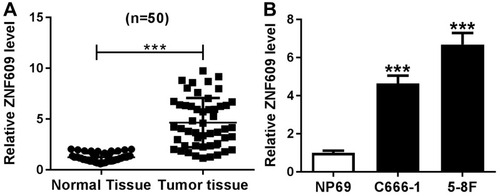 Figure 1 Circ-ZNF609 was downregulated in NPC tissues and cells. (A and B) Circ-ZNF609 expression was detected by qRT-PCR assay in NPC tissues and normal tissues (A) as well as NPC cells (C666-1 and 5-8F) and normal cells (NP69) (B). ***P<0.001.