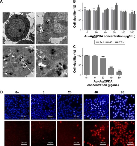 Figure 2 Cytotoxicity of Au–Ag@PDA NPs in T24 cells.Notes: (A) Ultrastructural changes of T24 cells treated with Au–Ag@PDA NPs for 24 hours. Top left: control T24 cells. Top right: Au–Ag@PDA NPs were internalized into T24 cells via endocytic pathways. Bottom left and right: Au–Ag@PDA NPs deposited in the lysosome. White spots representing Au–Ag@PDA NPs were observed in the lysosome. (B) Cytotoxicity of Au–Ag@PDA NPs in T24 cells. (C) Cytotoxicity of Au–Ag@PDA NPs after 808 nm laser irradiation at 1 W/cm2 for 4 minutes in T24 cells (0-: 0 µg+no laser, 0: 0 µg+laser, 20: 20 µg+laser, 40: 40 µg+laser, 80: 80 µg+laser). (D) Images of T24 cells treated with different concentrations of Au–Ag@PDA NPs after laser irradiation at 1 W/cm2 for 4 minutes. Necrotic T24 cells were strongly stained by PI (red); cell nuclei were labeled by Hoechst 33342 (blue). Each experiment was performed three times. ***P<0.001 vs 0 group.Abbreviations: NPs, nanoparticles; PDA, polydopamine; PI, propidium iodide.