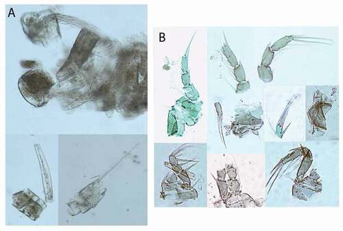 Figure 51. Stomach content of Pseudotanais kitsoni sp. nov. (a) and Akanthinotanais rossi sp. nov. (b). Apart from a foraminiferan tests (shells) now disintegrated under the coverslip, fragments of crustaceans (left) and unidentified fragments of “worms” are observed (right)