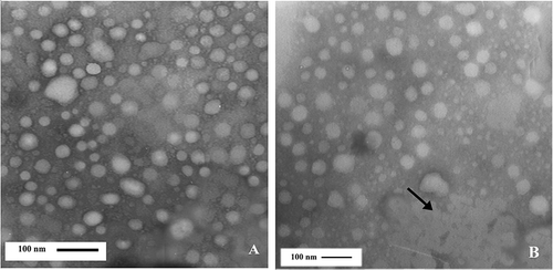 Figure 3 Electron micrograph of casein micelles in milk with more than 800,000 somatic cell counts cells/ml. Bar (A, B):100 nm.
