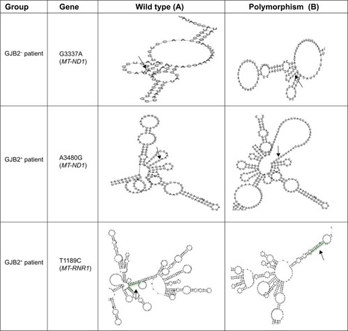 Figure 2 Comparison of RNA secondary structure analysis of wild type and polymorphic predicted in MT-RNR1 and MT-ND1 genes among patients with GJB2 mutation (GJB2+) and without GJB2 mutation (GJB2−).