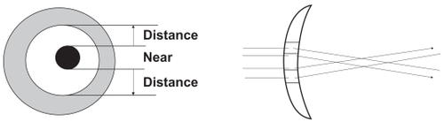 Figure 4 Diagram of a lens in which the optical axis coincides with the line of sight. In this design, the optical center of the lens is shifted slightly toward the nose so that it coincides with the line of sight. Since convergence and miosis occur at the time of near vision, this design is most suitable for near vision.