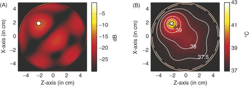 Figure 17. Power and temperature distribution of hyperthermia of a 6 mm tumour with 2.45 GHz microwave: (A) Power deposition, and (B) Temperature distribution.