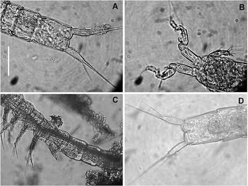 Figure 12. Kinnecaris iulianae sp. nov. Pictures taken with phase-contrast microscope at 40x. A, male, fourth and fifth urosomites, anal somite, anal operculum and caudal rami, ventral view. B, male, antennule, ventral view. C, female, legs 1 to 5, lateral view. D, female, fifth urosomites, anal somite, anal operculum and caudal rami, ventral view. Scale bar: 50 µm.