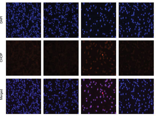 Figure S1 Fluorescence images of H1975 cell lines stained with CHOP. Cells were pretreated with 5 mM NAC for 2 h before exposure to 5 μM WZ35 for 12 h. Cells were stained with DAPI (blue) and CHOP (red).Abbreviations: NAC, N-acetylcysteine; CHOP, C/EBP-homologous protein; DAPI, 4′,6-diamidino-2-phenylindole.