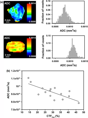 Figure 4. Examples of ADC images and frequency distributions of CK-160 tumors with low (top) and high (bottom) ADC values (a), and a plot of median ADC versus CTFCol for CK-160 tumors (b). Points represent single tumors. The curve was fitted to the data by linear regression analysis.