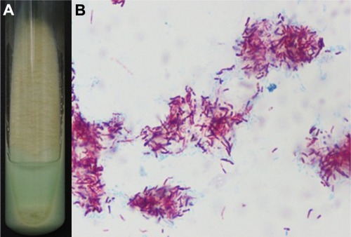 Figure 3 Pathogenic organism. (A) Mycobacterial cultures from the isolated lesional skin. (B) Smear from the cultured organisms with acid-fast stain.