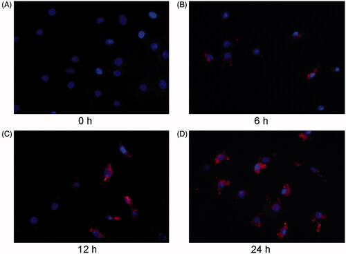 Figure 2. NRK-52E-derived MVs are labeled with orange fluorescent dye and incubated with cardiomyocytes. Microscopy image shows the internalization of fluorescently labeled MVs into cardiomyocytes. Donor NRK-52E cells were labeled with Dil-C18 (red). Control (A), cardiomyocytes incubated with MVs for 6 h (B), 12 h (C) and 24 h (D). ×400.