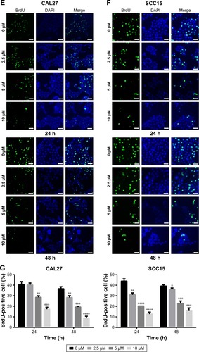 Figure 1 TBMS1 induced proliferation inhibition and morphological change in OSCC cells.