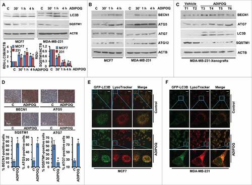 Figure 2. ADIPOQ/adiponectin induces autophagy in breast cancer cells. (A) Breast cancer cells were treated with 5 µg/ml ADIPOQ/adiponectin, and total cell lysates were immunoblotted for LC3B and SQSTM1/p62 expression. ACTB was used as a loading control. Bar diagram shows quantification of western blot signals from multiple independent experiments. (B) Immunoblot analysis of BECN1, ATG5, ATG7 and ATG12 in breast cancer cells treated with 5 µg/ml ADIPOQ/adiponectin as indicated. ACTB was used as a loading control. (C) Total protein lysates from tumors from control-adenoviral (Ad-Luc) and ADIPOQ/adiponectin -adenoviral (Ad-ADIPOQ)-treated mice were examined for the expression of BECN1, ATG7, LC3B and SQSTM1/p62. ACTB was used as a loading control. (D) Tumors from vehicle (V) and ADIPOQ/adiponectin-treated mice were subjected to immunohistochemical (IHC) analysis using BECN1, ATG5, SQSTM1/p62 and LC3B antibodies. Scale bar: 100 µm. Bar diagrams show quantification of IHC analysis. *P < 0.01, compared with control. (E,F) Breast cancer cells were transfected with an LC3B-encoding plasmid, treated with 5 µg/ml ADIPOQ/adiponectin and stained with LysoTracker Red. Scale bar: 20 µm. Representative immunofluorescence images are shown.