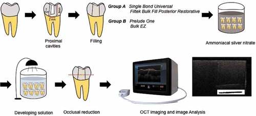 Figure 1. Schematic view of used methodology. Class-II cavities were prepared on proximal surfaces of extracted molar teeth. After restoration, the specimens were stored in 100% humidity for 24 h, immersed in ammoniacal silver nitrate followed by developing solution under a fluorescent light for 8 h. Specimens were reduced occlusally to be examined under CP-OCT, and obtained cross-sectional images were analyzed to quantify interfacial gaps