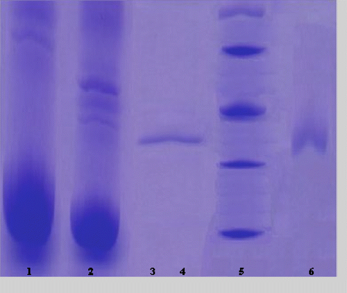 Figure 1 SDS-PAGE bands of GR (Lane 1: Hemolysate; Lane 2: Ammonium sulfate precipitation; Lane 3–4: Gel filtration chromatography; Lane 5: Standards: E.Coli βgalactosidase (116,000), rabbit phosphorylase B (97,400), bovine albumin (66,000), chicken ovalbumin (45,000), and bovine carbonic anhydrase (29,000); Lane 6: 2′, 5′-ADP Sepharose 4B affinity chromatography.
