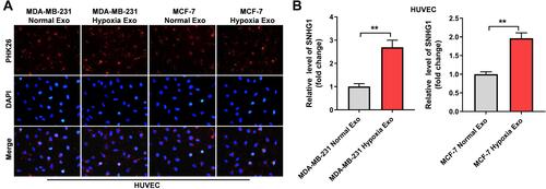 Figure 2 SNHG1 can be transferred from hypoxic breast cancer cells to HUVECs via exosomes. (A) Exosomes were isolated from breast cancer cells under hypoxia or normoxia. Then, PKH26-labeled exosomes were co-cultured with HUVECs for 48 h, and the fluorescence signal was observed by microscopy. (B) Exosomes were isolated from breast cancer cells under hypoxia and normoxia. Then, RT-qPCR analysis of SNHG1 level in HUVECs co-cultured with indicated exosomes. **P<0.01; n = 3.