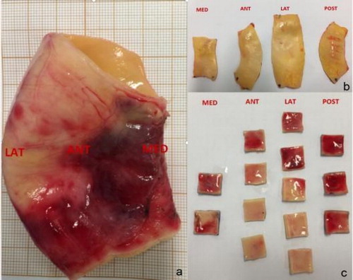 Figure 1. AsAA wall tissue. (a) Global human AsAA segment; (b) Sample pieces from each quadrant (intima view); (c) Subsequent processing for obtaining 15 mm x 15 mm specimens (adventitia view).