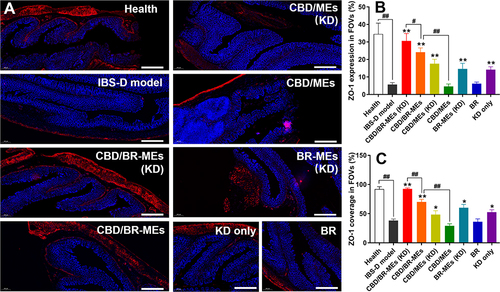 Figure 6 Studies of intestinal permeability. (A) Immunofluorescence staining of ZO-1. The bar is 500 μm. (B) Expression of ZO-1 in 5 randomly-selected FOVs. (C) Coverage ratio of ZO-1 in 5 randomly-selected FOVs. Data are represented as mean ± SD, n = 5. *P < 0.05, **P < 0.01, compared with the IBS-D model; #P < 0.05, ##P < 0.01. Quantification was calculated by ImageJ software.