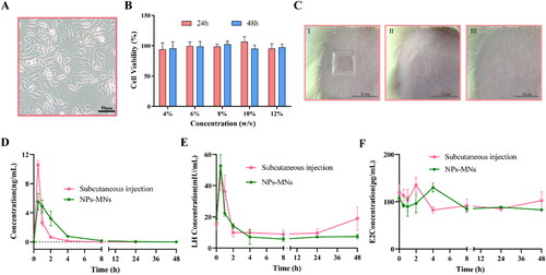 Figure 7. Safety and in vivo studies of nanoparticles-encapsulated polymeric microneedles (NPs-MNs). Morphology of L929 cells in a 96-well plate covered with silk fibroin (SF) membrane (a). Cell viability of L929 cells incubated for 24 h or 48 h in a 96-well plate covered with SF membrane. (B). Images of rat skin after application of nanoparticles-encapsulated polymeric microneedles (NPs-MNs) (I), immediately (II) and 1 d (III) after removal of the MNs base (C). Mean plasma concentration–time profiles for triptorelin in rats administered NPs-MNs (9 μg/kg) and injected with triptorelin (9 μg/kg, s.c.) (n = 8). (D). Plasma concentration for luteinizing hormone (LH) (E) and estradiol (E2) (F) in rats administered NPs-MNs and injected (s.c.) with triptorelin (n = 8).