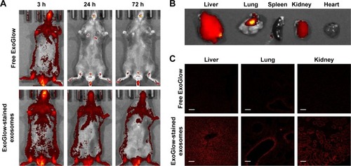 Figure 4 Distribution of exosomes after injection of exogenous exosomes labeled with an exosome-specific dye (ExoGlow™-RNA, System Biosciences, Inc.).Notes: (A) Whole-body imaging for 3 days after exosome administration; (B) ex vivo imaging of exosome distribution in mouse tissues; (C) distribution of exosomes in the section of liver, lungs, and kidney observed using a confocal microscope.