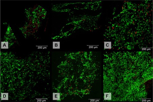 Figure 6 Viability of 3T3 fibroblasts cultivated on the surface of (A) polypropylene (PP) mesh, (B) PP mesh treated with thrombocyte-rich solution (TRS), (C) PP mesh functionalized with poly-ε-caprolactone (PCL) nanofibers, (D) PP mesh functionalized with PCL nanofibers treated with TRS, (E) PCL nanofibers, and (F) PCL nanofibers treated with TRS on Day 14 after seeding. Live/dead cell staining revealed a higher percentage of viable cells on all scaffolds functionalized either with PCL nanofibers or with TRS than on the scaffold without any functionalization or treatment (PP). The percentages of viable cells cultivated on the various surfaces of the scaffolds were: (A) 59.5%, (B) 85.4%, (C) 88.3%, (D) 90.1%, (E) 90.3%, and (F) 94.7%.Notes: The viability of 3T3 fibroblasts was evaluated on Days 1, 3, 7, 10, and 14 after seeding. For simplification, only data obtained on Day 14 are presented. Viability was calculated as the percentage of live cells from the total cell count per unit area. Live cells are stained green. Dead cells are stained red. Scale bar 200 μm.