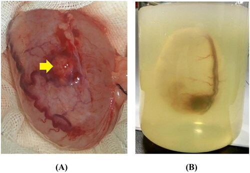 Figure 1. Preparation of a cystic neoplasm mimic model. (A) The VX2-implanted tumor bladder showed that the bladder mucosa was smooth, the blood vessels were clearly visible on the surface, and the VX2 tumor (yellow arrow) was located in the anterior wall of the bladder. (B) The VX2-implanted tumor bladder was immersed in agarose solution that had been cooled to 40–45 °C and kept intact in the solution. The gel fixation matrix was formed by leaving it at room temperature (23 °C) for approximately 40 min to complete the development of cystic neoplasm mimic models.