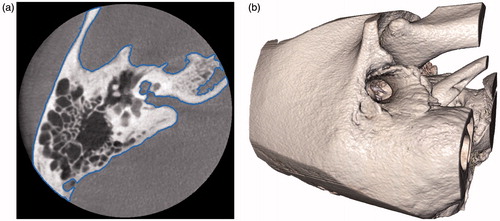 Figure 3. A slice of a temporal bone image from a cone beam CT that shows the bone surface isocontour in blue (a) and the corresponding isosurface rendered in 3D (b).