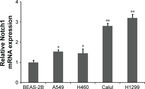 Figure S1 Relative expression levels of Notch1 mRNA were detected in four NSCLC cells and one cultured human lung epithelial cells via qRT-PCR.