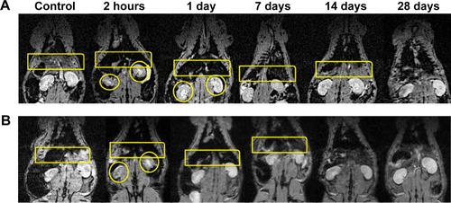 Figure S1 MRI monitoring the chest of a male Wistar rat just before (control), and 2 hours, 1, 7, 14, and 28 days after IV administration of 10 mg/kg of cat-USPIOs.Notes: Images from (A) the control group (without a magnet) and (B) the experimental group (with a magnet in the left thigh). A yellow rectangle indicates the region where the liver and the spleen are localized while yellow circles indicate the kidneys.Abbreviations: MRI, magnetic resonance imaging; IV, intravenous; cat-USPIOs, cationic ultrasmall superparamagnetic iron oxide nanoparticles.