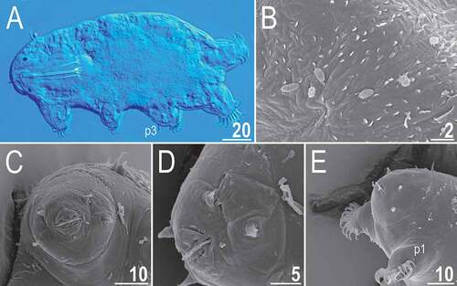 Figure 18. Detailed morphology of Echiniscoides trichosus sp. nov. (all but A in SEM): A. specimen in toto (DIC), B. dorsal sculpturing in the form of microtrichia, C. cephalic body portion with peribuccal cirri in frontal view, D. cephalic body portion with peribuccal cirri in lateral view, E. anterolateral body portion of paratypic female. Scale bars in μm.