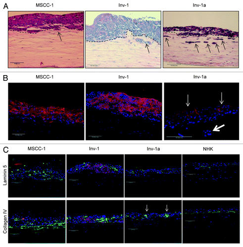Figure 4. E-cadherin is re-expressed in Inv-1a cells when grown in the context of a 3D tissue. (A) Tissues generated from MSCC-1, Inv-1, and Inv-1a cell lines were stained with hematoxylin and eosin to examine the tissue architecture. The dashed black lines indicate the interface of the epithelium and the underlying stroma. Black arrows indicate the invading cells. (B) Immunohistochemical staining of 3D tissues for E-cadherin (red) and dapi (blue) reveal E-cadherin staining in all three tissue types. The E-cadherin positive Inv-1a cells are indicated by thin white arrows, while the thick white arrow indicates Inv-1a cells that have invaded into the stroma but do not express E-cadherin. (C) Immunohistochemical staining of 3D tissues for the basement membrane proteins (green) Laminin 5 and Collagen IV in relation to E-cadherin (red) and dapi (blue) in all three tissue types. Tissue made of normal human keratinocytes served as a control. E-cadherin negative Inv-1a cells in conjunction with abnormal Collagen IV staining are indicated by the white arrows. Scale bars = 100 µm.