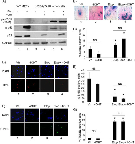 FIG 4 4OHT restores p53 activity in p53ER(TAM) cells and has no effect on explanted Irbp-Cyclin D1, p53−/− tumor cells. (A) Western blotting for the indicated proteins in wild-type MEFs (WT MEF) as controls and in p53ERTAM pineal tumor cells treated for 48 h with 10 μM etoposide (Etop) or vehicle and with 4-hydroxytamoxifen (4OHT) or vehicle. GAPDH was used as a loading control. (B, D, and F) Representative staining for SABG (B) and BrdU (D, lower), and the corresponding DAPI nuclear stain (D, upper), at 7 days after treatment and TUNEL staining (F, lower) and the corresponding DAPI nuclear stain (upper) at 48 h after treatment in explanted Irbp-Cyclin D1, p53−/− pineal tumor cells treated with vehicle (Vh), 4OHT, etoposide, or both (Etop + 4OHT), as indicated. (C, E, and G) Percentages of SABG-positive area (C), BrdU-positive cells (E), and TUNEL-positive cells (G) under the conditions shown in panels B, D, and F, respectively. Each point represents the means from at least 5 fields and is representative of 2 independent experiments. Bars represent standard deviations, and asterisks denote a statistically significant difference (P < 0.05) relative to the respective control conditions (Vh and 4OHT, respectively). NS denotes nonsignificance relative to the condition shown by the horizontal bar.